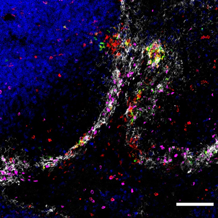 Marc Dalod (@dalodciml) on Twitter photo Please look up at our paper to visualize movies featuring 3D reconstructions of interactions between pDC and infected cells in vivo in the spleen of mice! rdcu.be/c7MWX
#plasmacytoid, #dendritic, #intersectional, #genetics, #IFN, #MCMV
<a href="/NatImmunol/">Nature Immunology</a> Please look up at our paper to visualize movies featuring 3D reconstructions of interactions between pDC and infected cells in vivo in the spleen of mice! rdcu.be/c7MWX
#plasmacytoid, #dendritic, #intersectional, #genetics, #IFN, #MCMV
<a href="/NatImmunol/">Nature Immunology</a>