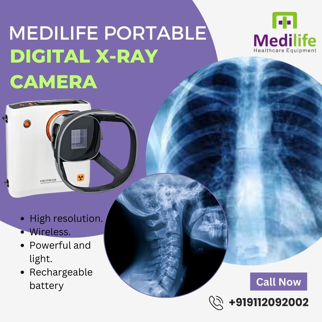Medilifemktg's tweet image. Portable X-Ray  Machine- REMEX KA-6

Super Portable X-Ray Equipment. High resolution. Wireless. Powerful and light. Rechargeable battery etc . To know more call now on 9112092002.
#portablexraymachine #DigitalHandheldXRayCamera #DigitalXRayMachine #HandheldXRayCamera