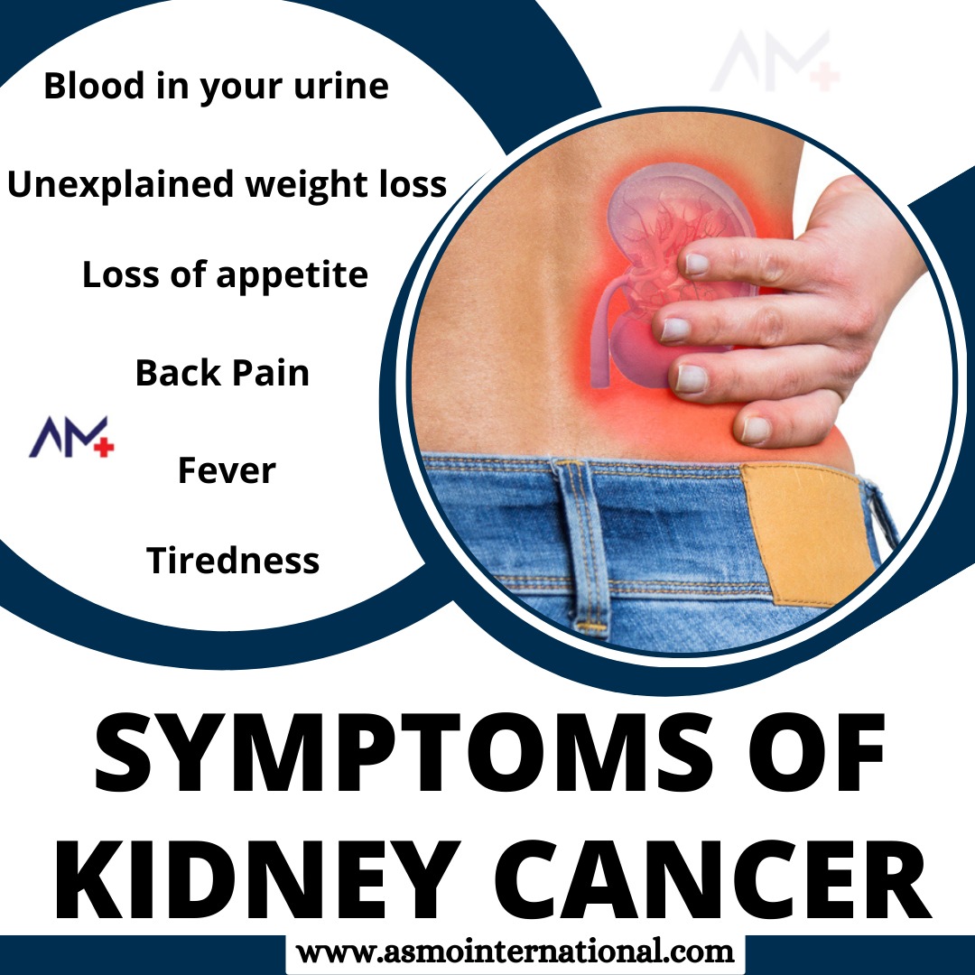 Symptoms of Kidney Cancer
.
bit.ly/3nHERKo
.
#kidneys #kedneystones #kidneydisease #kidneytransplant #kidneyhealth #kidneyfailure #kidneydonor #kidneydiet #kidneycancer #kidneywarrior #asmointernational #asmohealth #asmomedicines #asmocare #asmoresearch #asmo