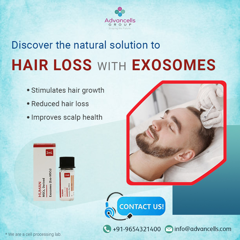 Discover the ultimate solution to #hairloss with exosomes - the natural and effective way to stimulate #hairgrowth! 

#antiaging #cosmeticscience #activeingredients #cosmeticsformulation #haircare #hairlosstreatment #exosomes