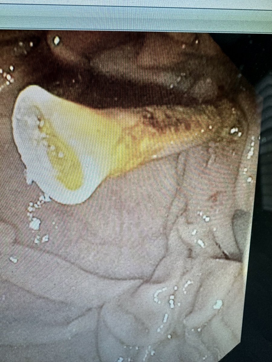 Neil Bhogal, MD tweet media