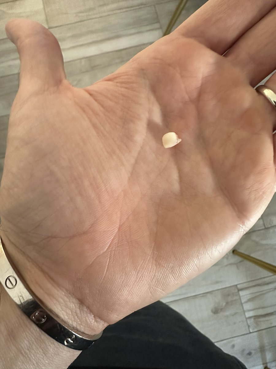 eliz883's tweet photo. my daughter lost her tooth... she asked the tooth fairy for 1 $BTC lol 🧚‍♀️ https://t.co/SSXAqXAOTY