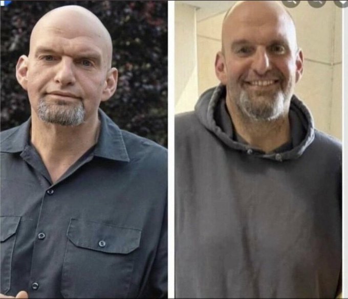  What’s Up with John Fetterman’s New Face?  FsE5jQMXoAUGs1W?format=jpg&name=small