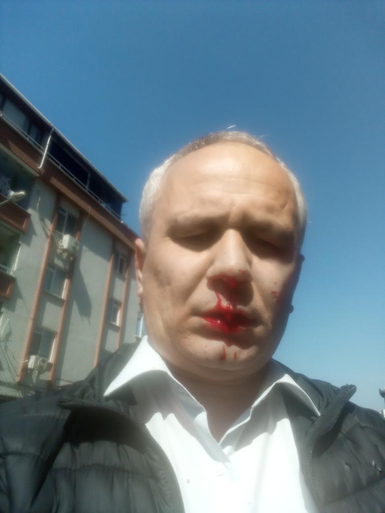 Az önce evimin önünde saldırıya uğradım. Kendimi eve zor attım. Ellerinde sopalarla Allahu Ekber deyip saldırdılar.