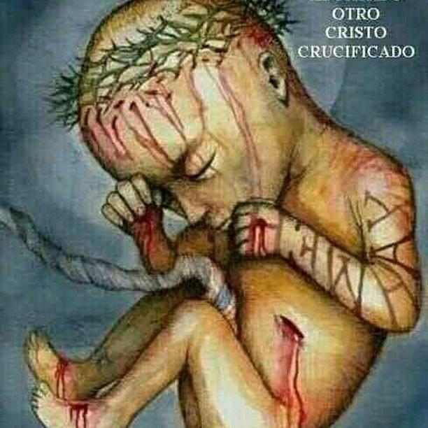 undiaunico's tweet photo. No al aborto #GuayanaEsProvida https://t.co/PkQQsmTE5H