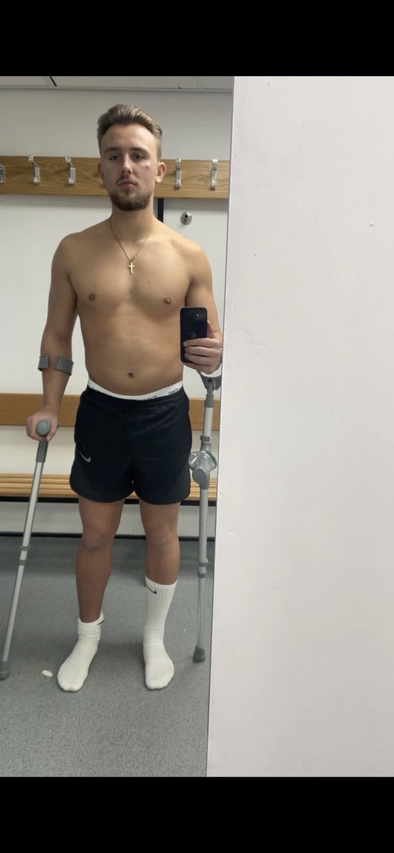 scottty_'s tweet photo. Now Vs 2 months ago post leg break. @HanworthVillaFC I’ll be back ❤️🤍 https://t.co/E2Xvd4ViA8