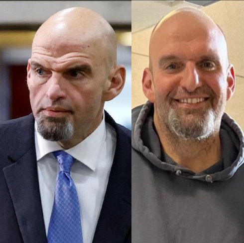 This Fettermen Story Is Getting Bizarre! MSM Fact Checks Fetterman “Body Double” Conspiracy – He’s Probably Dead