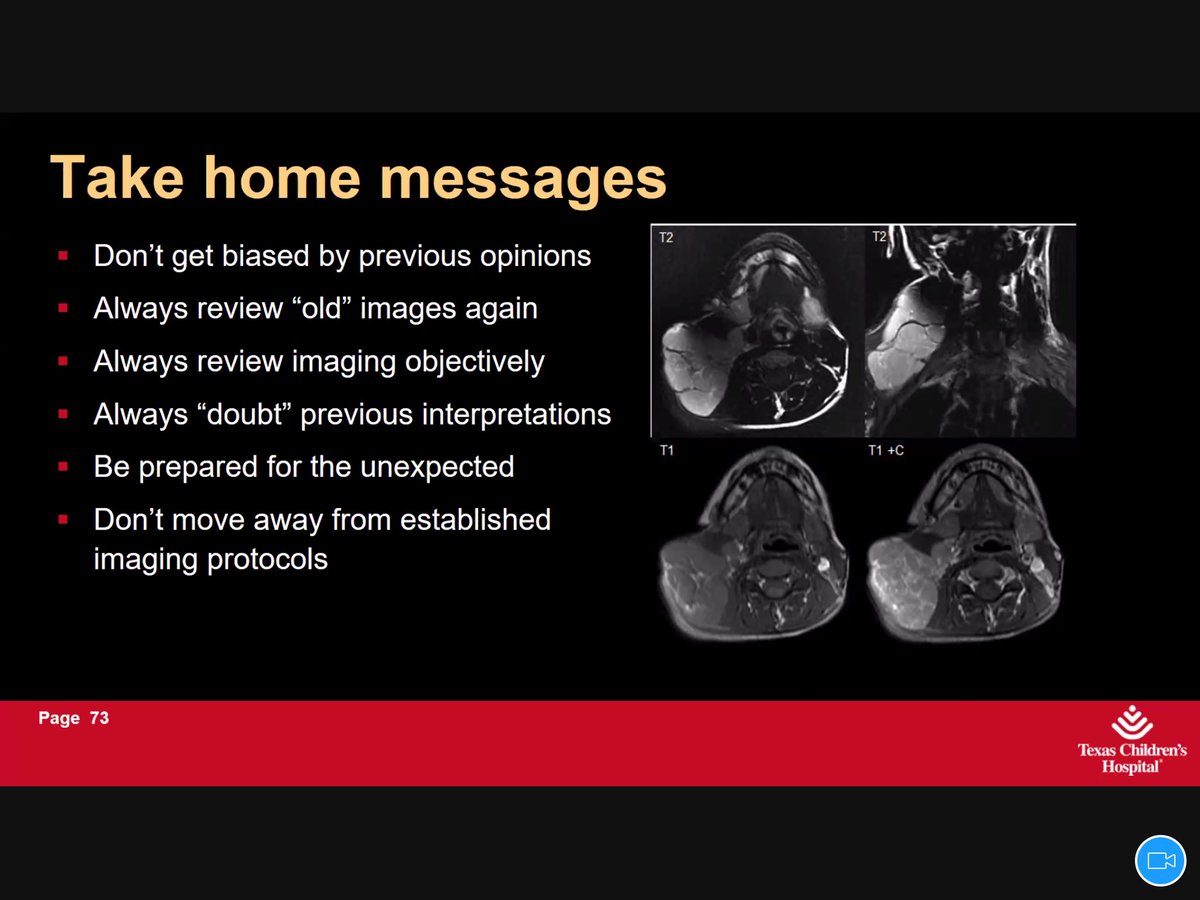 Season IV of #IPNTN Too err is human:
A real class room feel with the experts #TCH 

Key lessons:
1.CCFistula in Pead>E.Danhlos
2.Look beyond the brain>Parry Romberg
3.Mitoch ds can involve any even the spine!
4.Sometimes you don’t know what it is,say it
5.The Last slide speaks