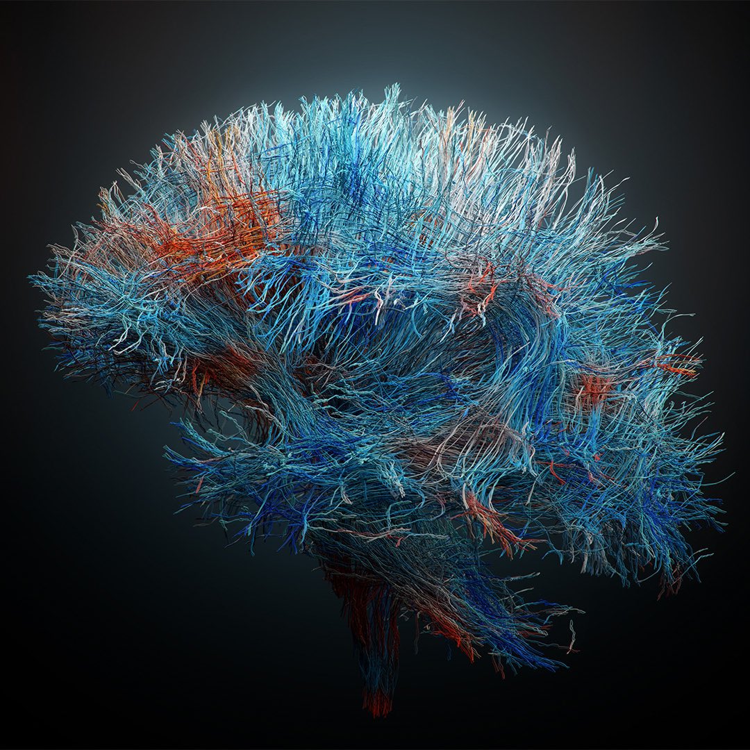 PBialasz's tweet photo. @curtisjamesholt @Bbbn192 How about that? I’ve also made it in Blender using MRI scan 😎 https://t.co/ad87ZqzHHy
