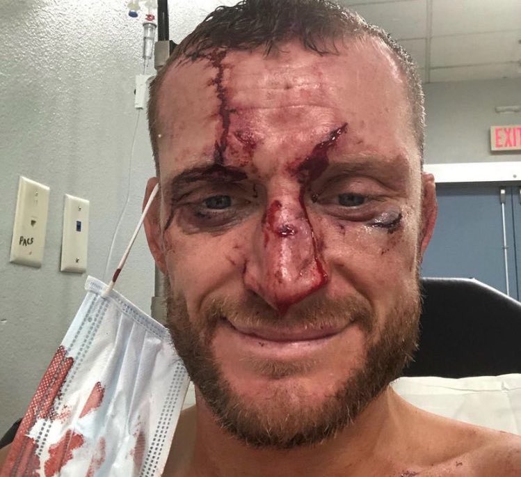 ClinchPerfect's tweet image. It’s a Chito Saturday everyone, enjoy the violence #UFCSanAntonio