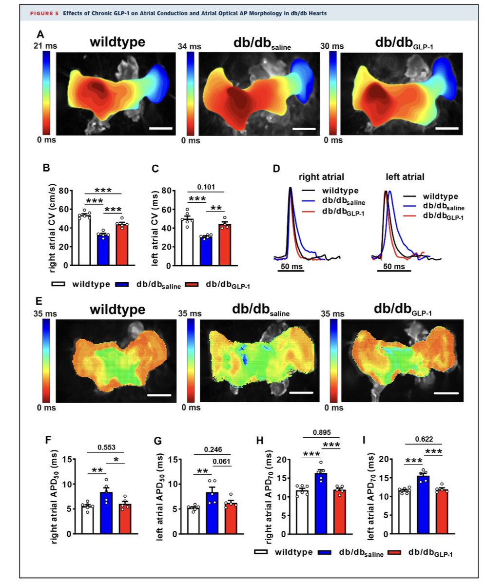 #GLP 1 Protects AgainstAtrial Fibrillation and Atrial Remodeling in Type 2 Diabetic 🐁 👉 mice are highly susceptible to AF in association with atrial electrical and structural remodeling 👉GLP-1, as well as the long-acting GLP-1 analogue liraglutide, ⬇️ jacc.org/doi/10.1016/j.…