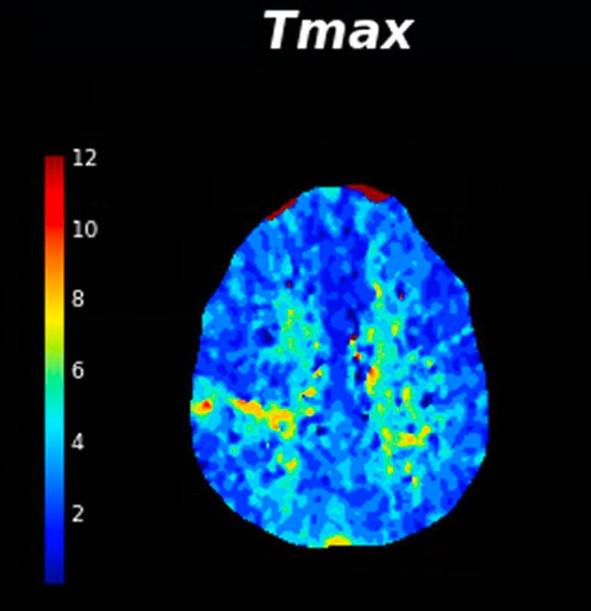 Andrew Micieli tweet media