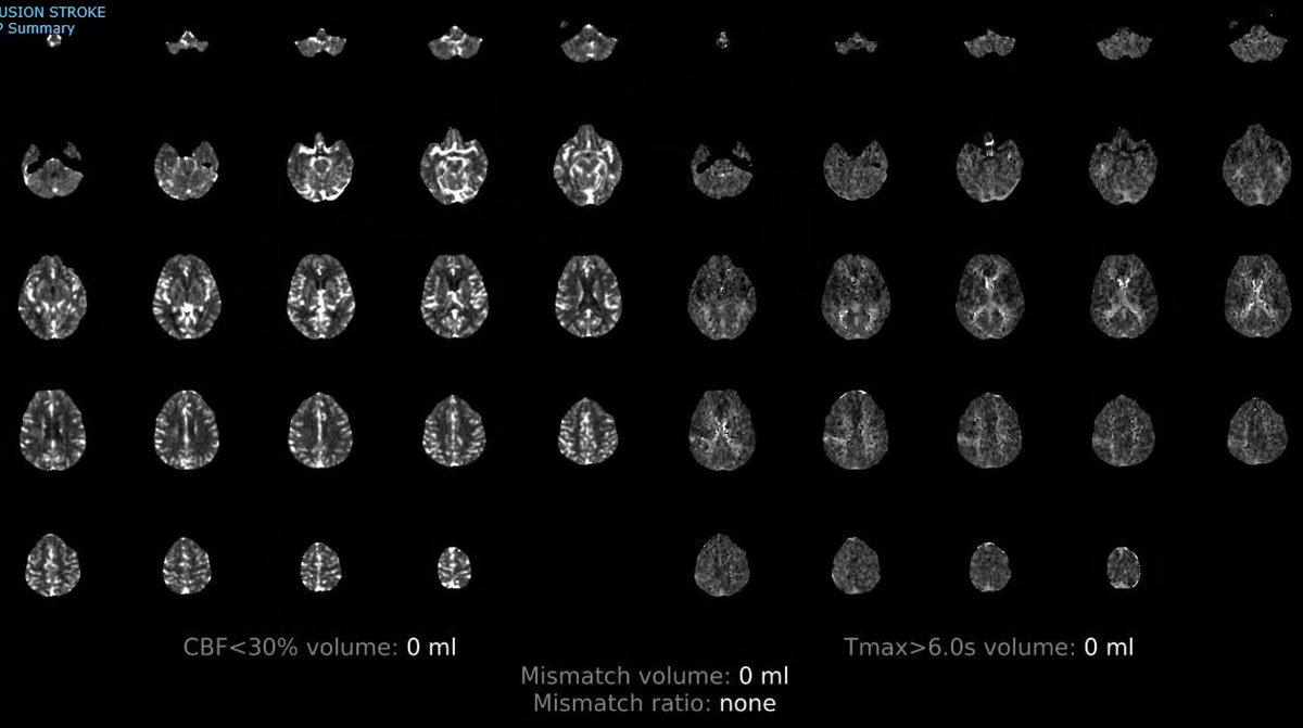 Andrew Micieli tweet media