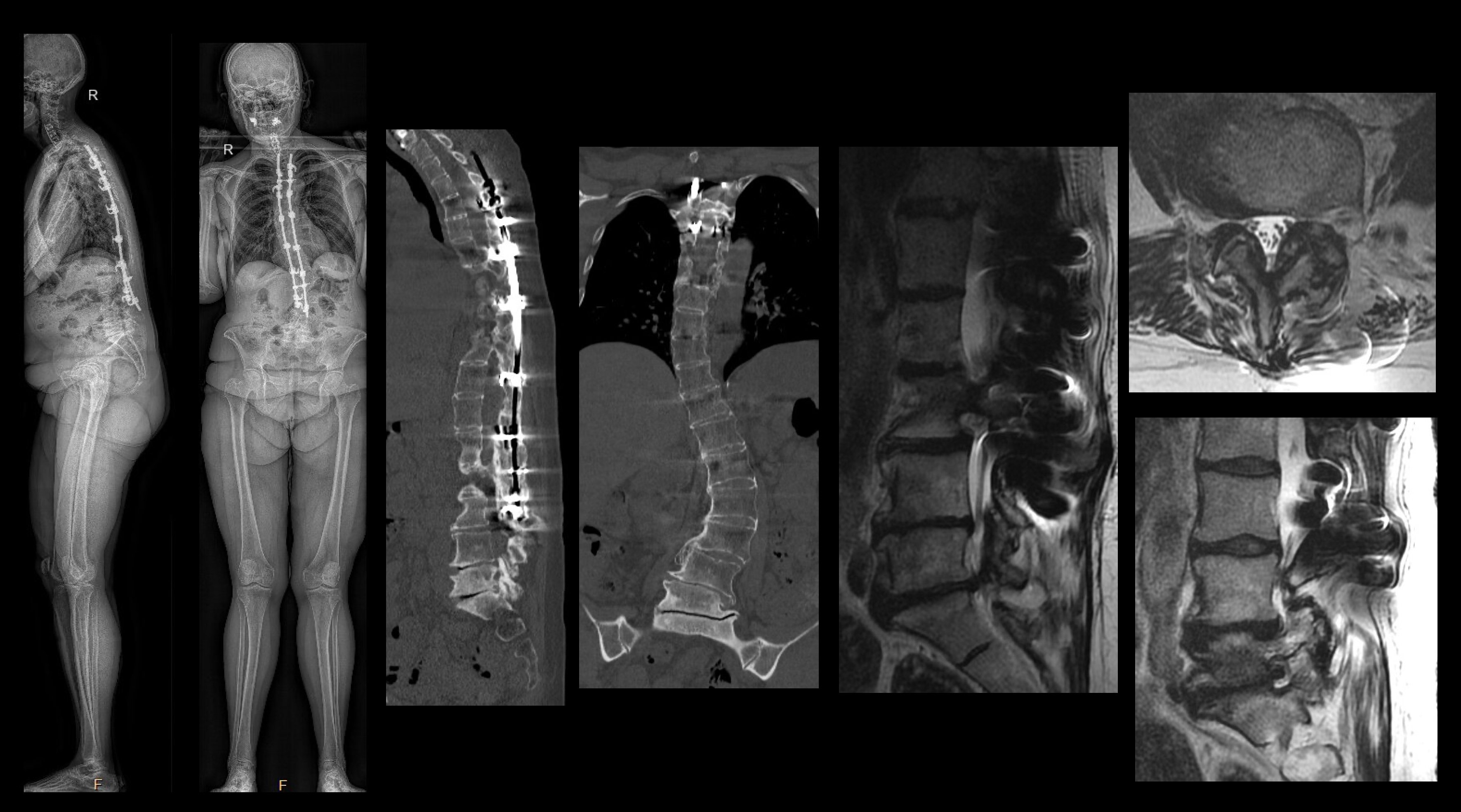 AANS/CNS Spine Section (spinesection) / Twitter