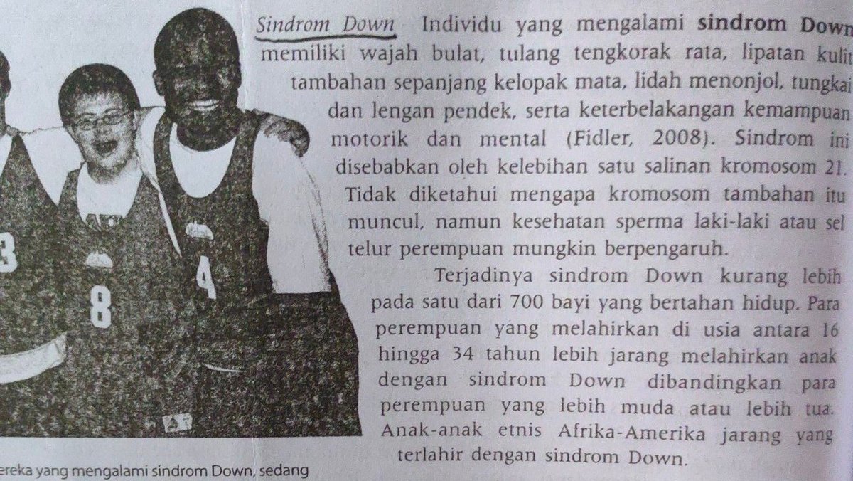 Purpleizers's tweet photo. @cewie @milkydrobb @18fesss Dari buku kak, tapi kemungkinannya 1:100 kalo melahirkannya di usia 35-40 an. Dan 1:10 kalo melahirkannya di usia 50 an https://t.co/t7MXCC815W