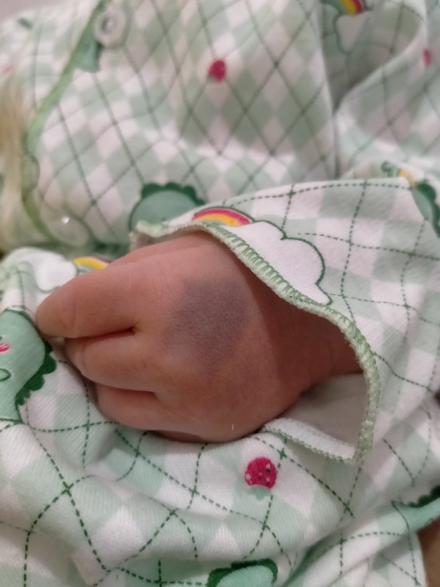 my nephew was born on march 23 yesterday and he has a birthmark on his hand like Renjun!!👶💚 @NCTsmtown_DREAM