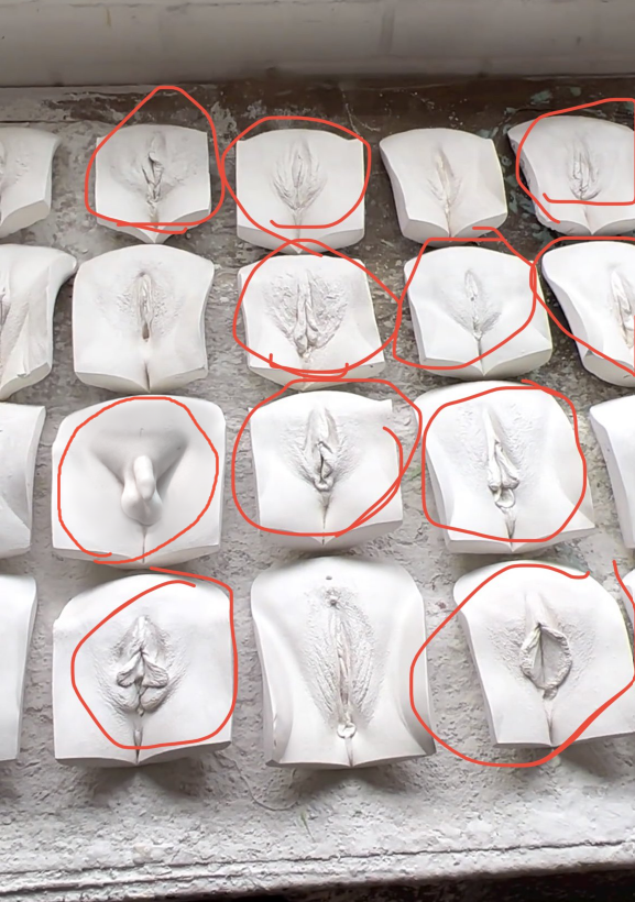 These vulvas circled in red are, by contrast, OBVIOUSLY FEMALE. 

People should be able to know what female anatomy looks like. 

It looks like these!