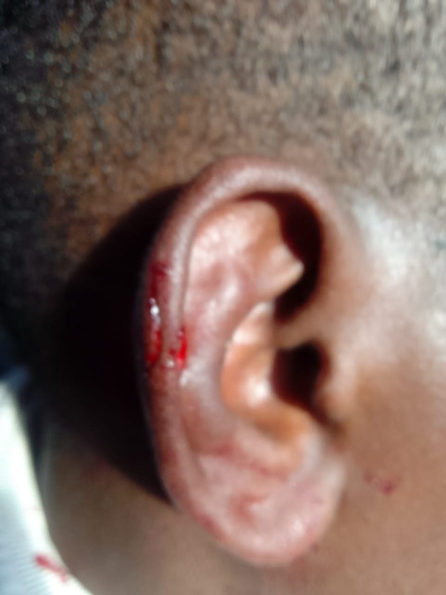 AmuB12's tweet photo. @SAPoliceService. @SABCNews    @News24   
 so I was told that my case is useless.while I pointed the guy n now his a free man.
Message from SAPS. Case registered on 2023-03-26 at DOBSONVILLE Station. ref nr CAS 449/3/2023 - contact details: 011-9831540. Do NOT reply to this SMS. https://t.co/41mzmddKXr