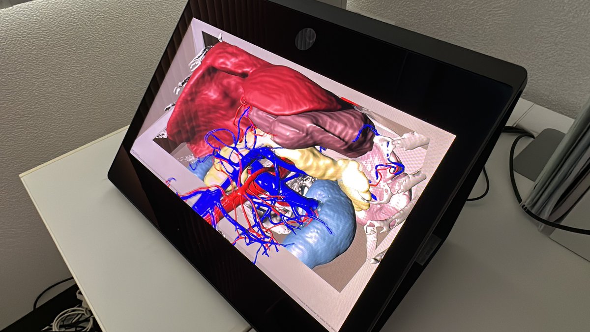 t_itamiya's tweet photo. 静止画キャプチャです。#ELFSR1 #SRView #肝胆膵 https://t.co/Dh47XKXGFG