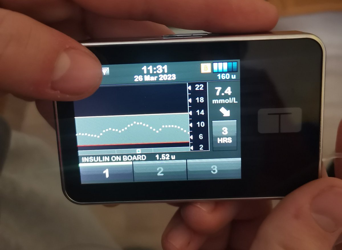 CarolineRuby_T1's tweet image. 3 hours solid kickboxing training today (Inc asthma attack so had to take steroid  inhaler 😏 powered through though 💪) No need for carbs beforehand. No hypos thanks to @dexcom and #tslim #t1warrior #dexcomwarrior #DiabetesTechCantWait