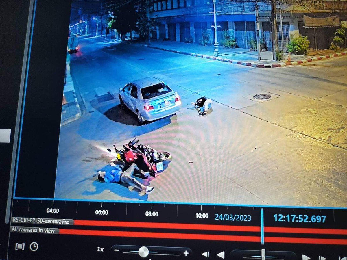 14aehyuno's tweet image. รบกวนช่วยรีทวิตหน่อยค่ะ พี่สาวเราถูกรถชนแล้วคู่กรณีขับหนี บริเวณสี่แยกหมอพีระ ช่วงเวลาประมาณตี 2.17 น. ของวันที่ 25/03/66 ตอนนี้พี่สาวเรามีภาวะเลือดคลั่งในสมองอยู่ในห้อง ICU ส่วนพี่ชายเราคนขับฟันหน้าหักและคิ้วแตกค่ะ #ทวิตดีคนรีน้อย #โหนกระเเส #เชียงราย