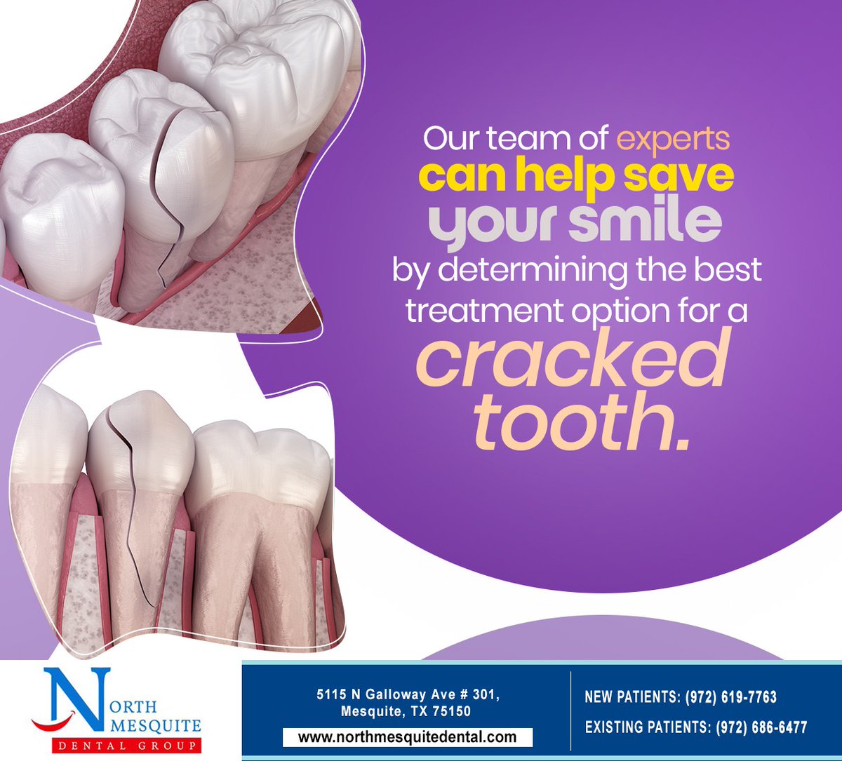 drtinafoss's tweet image. A cracked tooth can cause sudden pain and other symptoms. If you suspect you have a cracked tooth, speak to us at 972-686-6477, and we will determine suitable treatment to save your tooth. #crackedtooth #NorthMesquiteDentalGroup #Mesquite #TX