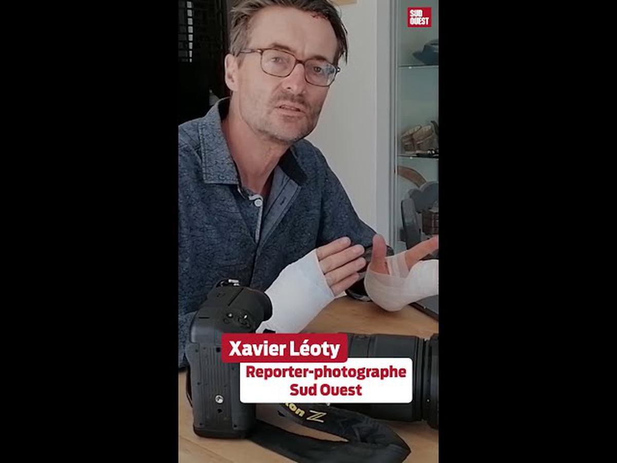 SO_LaRochelle's tweet image. Affrontements à Sainte-Soline : « on a pris un cocktail molotov à côté de la tête », le témoignage de notre photographe blessé lors de la manifestation sudouest.fr/economie/agric…