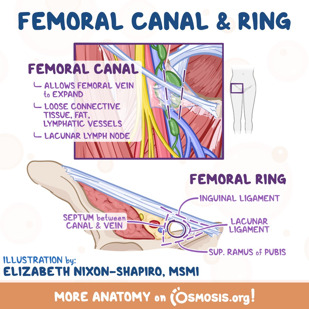 Femoral Hernia Anatomy femoral-hernia-anatomy