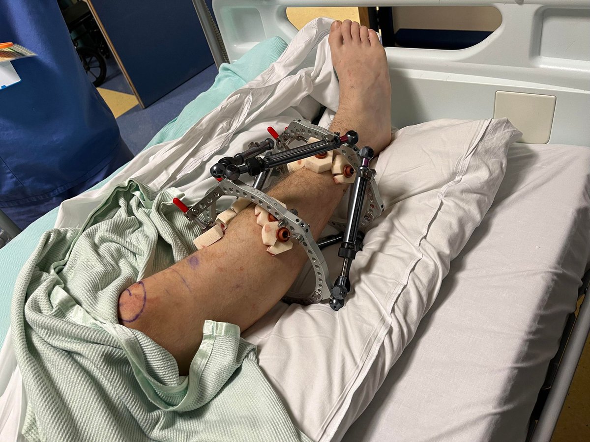 Teamgrassroots_'s tweet image. My son plays for Market Weighton Town u15s in the Hull league and last November suffered a severe break to his lower leg from an innocent 50/50 challenge. The team they were playing were Hall Road Rangers. 
Today we received a huge hamper and card from the player on the other end…