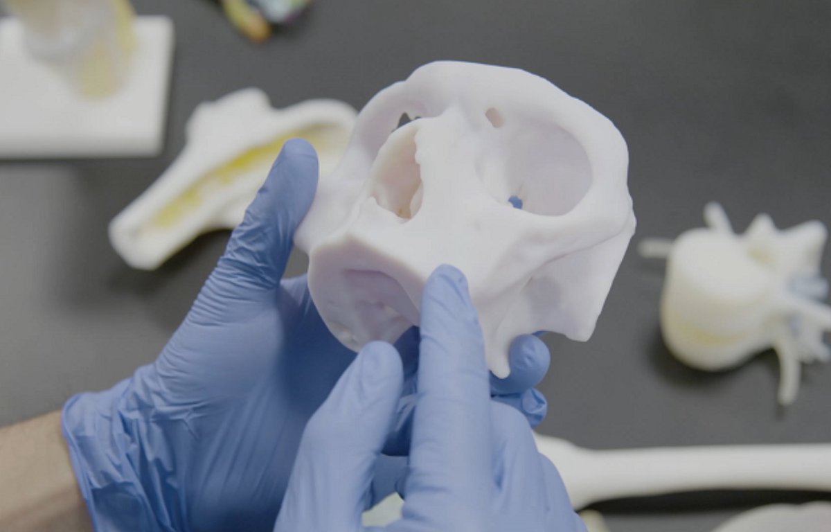 3dheals's tweet image. @Ricoh, @Stratasys, &amp;amp; @Axial3D Partner to Increase Access to #3DPrinted #Anatomic #MedicalModels
bit.ly/3FLCZvm #3dhealslattice #medical3dprinting