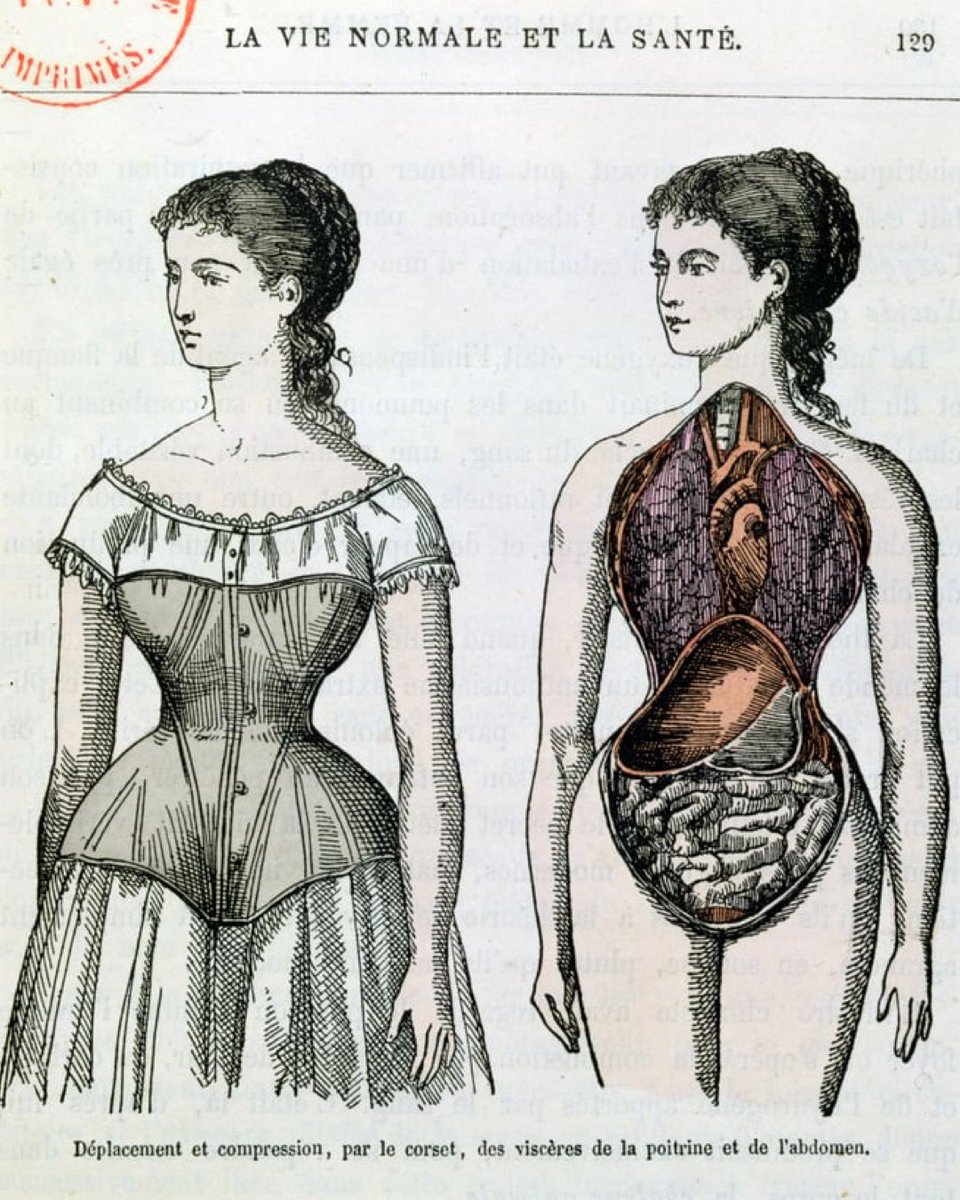 Trenhistoria's tweet photo. 🆕😳
Cotilles com presons.
Les dones les portaven tan ajustades que tenien problemes de salut.
Ens ho explica Sílvia Ventosa del @museudeldisseny a https://t.co/eLwYwNIeVU
#Podcast #Història #Moda #Fashion #Fashionhistory #Design #Modernisme #Modernism #costumehistory https://t.co/IbNNtqRu28