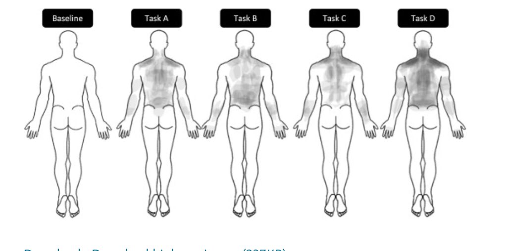 Retlouping's tweet photo. Prolonged slumped sitting causes neck pain and increased axioscapular muscle activity during a computer task in healthy participants – A randomized crossover study

https://t.co/8e8ND2ELtK https://t.co/0Gfoi7FUNC