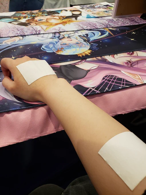Ouch, I sprained my arm  my right arm  