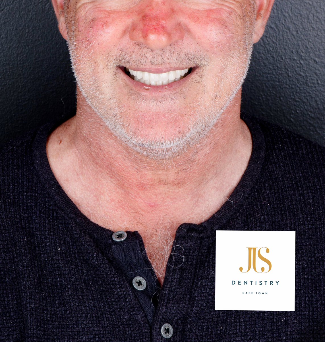 SMILEMAKEOVER!
Dental implants, orthodontics, veneers , crowns!