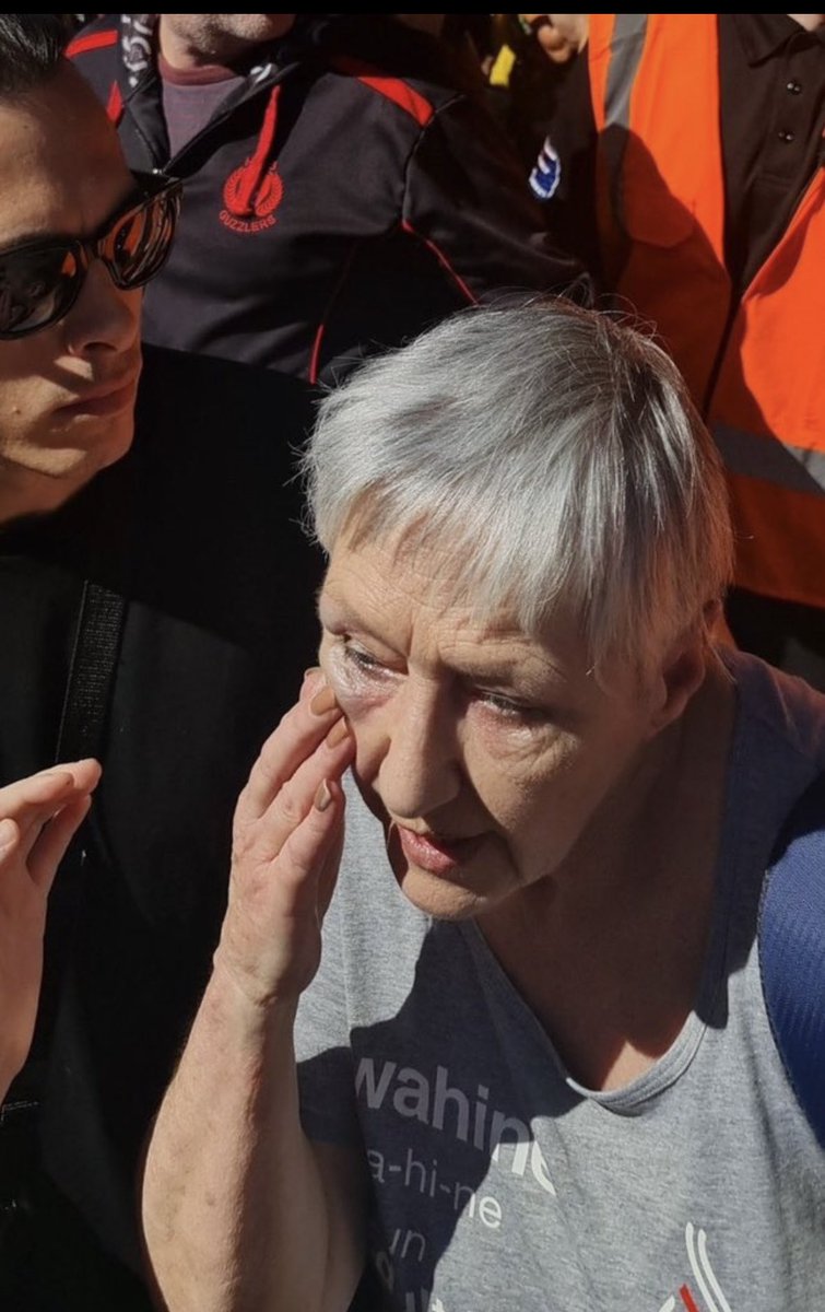 70 Year Old Lady tends to her wound after being punched repeatedly in the face by a TRANS Activist. 

Despite being violently beaten, the woman remained at the Women’s Rights Rally in NZ 🇳🇿afterwards to show solidarity with all the other women. 

God bless her! 🙏🏻
