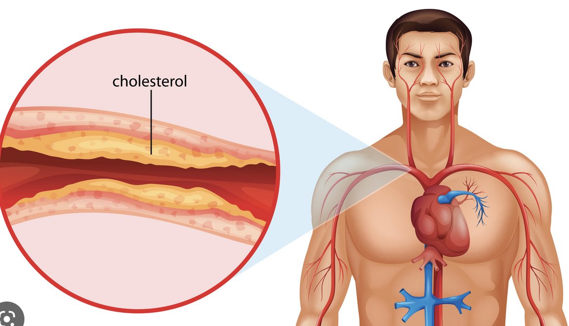 ➡️ Last week, I asked you if you want to bring down your cholesterol levels, and almost 700 people collectively replied 'yes' to that tweet and DMed me as well. Let's deep dive into one of the most famous words in the health sector 'Cholesterol.' A very long ride. Thread 🧵