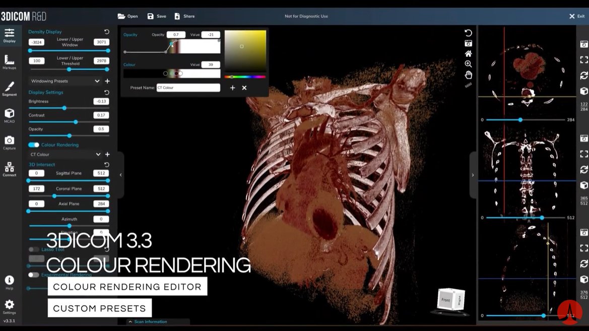 💡 DID YOU KNOW?

We have recently released a version 3.3 of our #3Dicom Software.

✅ Computer-Aided Design Tools
✅ New Colour Rendering Presets
and much more!

Have you tested our latest version?
⬇️ Let us know down below!

#SingularHealth