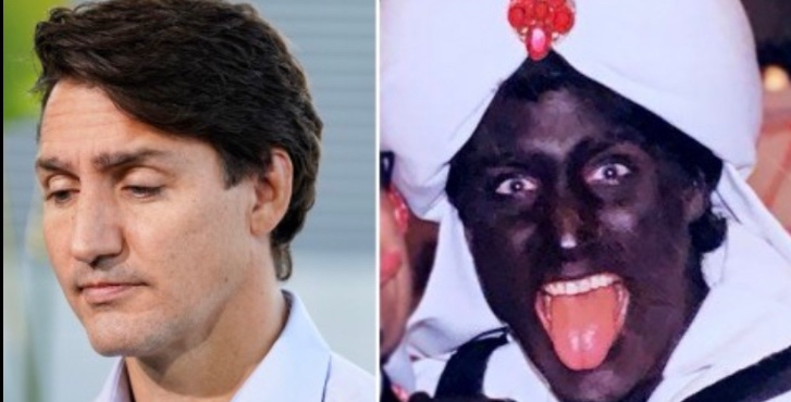 What about real #blackface ?

#TrudeauBlackface

Canada’s PM @JustinTrudeau 
Repeat offender