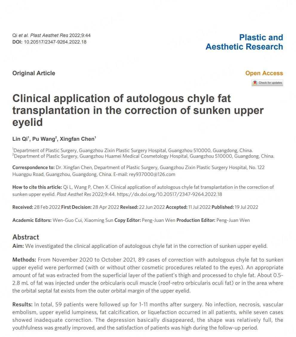 PARjournal's tweet photo. #Sunken #Upper #Eyelid #Autologous #Chyle #Fat
👏👏Happy to share the interesting publication about Clinical application of autologous chyle fat transplantation in the correction of sunken upper eyelid.
🤵Dr. Xingfan Chen's team
🔗https://t.co/zX8nOX727x https://t.co/IcGqXzqj6V