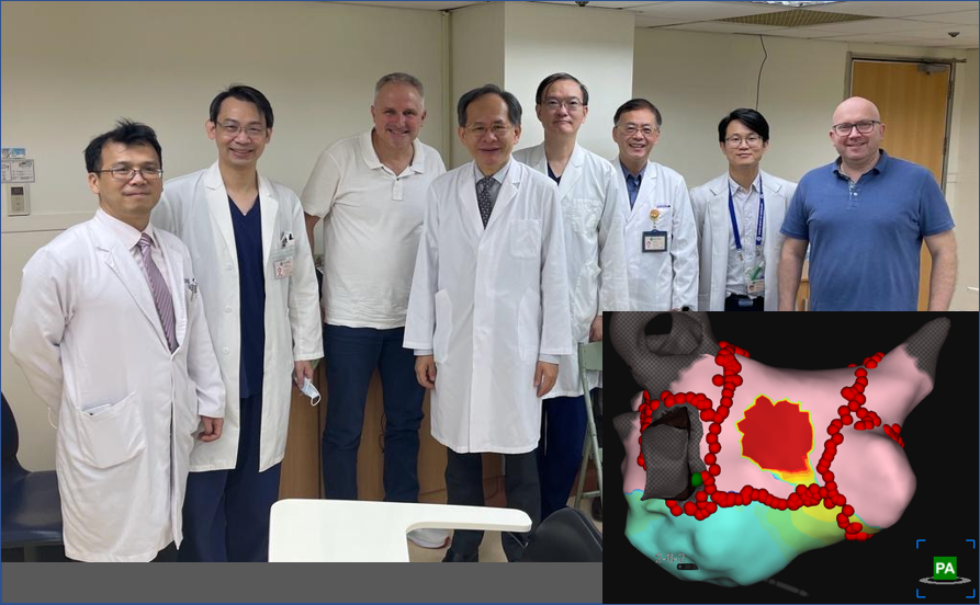 BIOTRONIK_News's tweet photo. Successfully treated the first two patients with the #AcQMap 3D Imaging & Mapping System at Taichung Veterans General Hospital in Taiwan. Thanks to Superintendent Prof. Shih-Ann Chen and the whole team for making this happen!
#Electrophysiology #EPeeps #Ablation #Arrhythmia https://t.co/26pvFnQcFG
