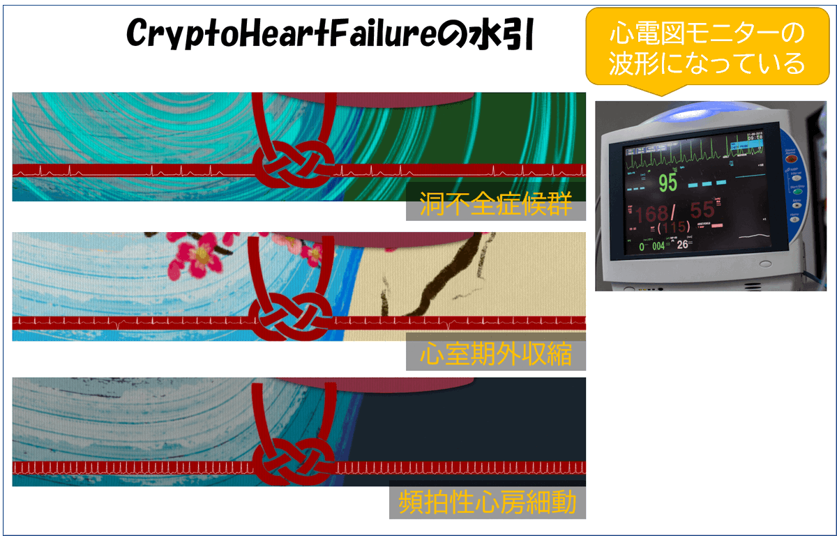 【CryptoHeartFailureの水引】
CryptoHFの下部には水引があります

実は，この中には心電図が隠れてます

これは心電図モニターの波形です

この水引は全ての作品で異なっており，それぞれの疾患やストーリーと整合性のある形状になっています
#CryptoHF mtbrs.net/ps_drppooohhnf…