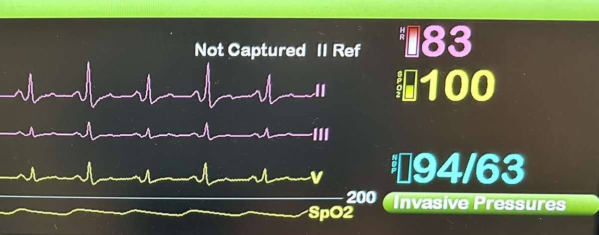 Patient admitted for a COPD exacerbation. You see the patient in the ED an hour after admission and look at tele and see this…what do you do next?