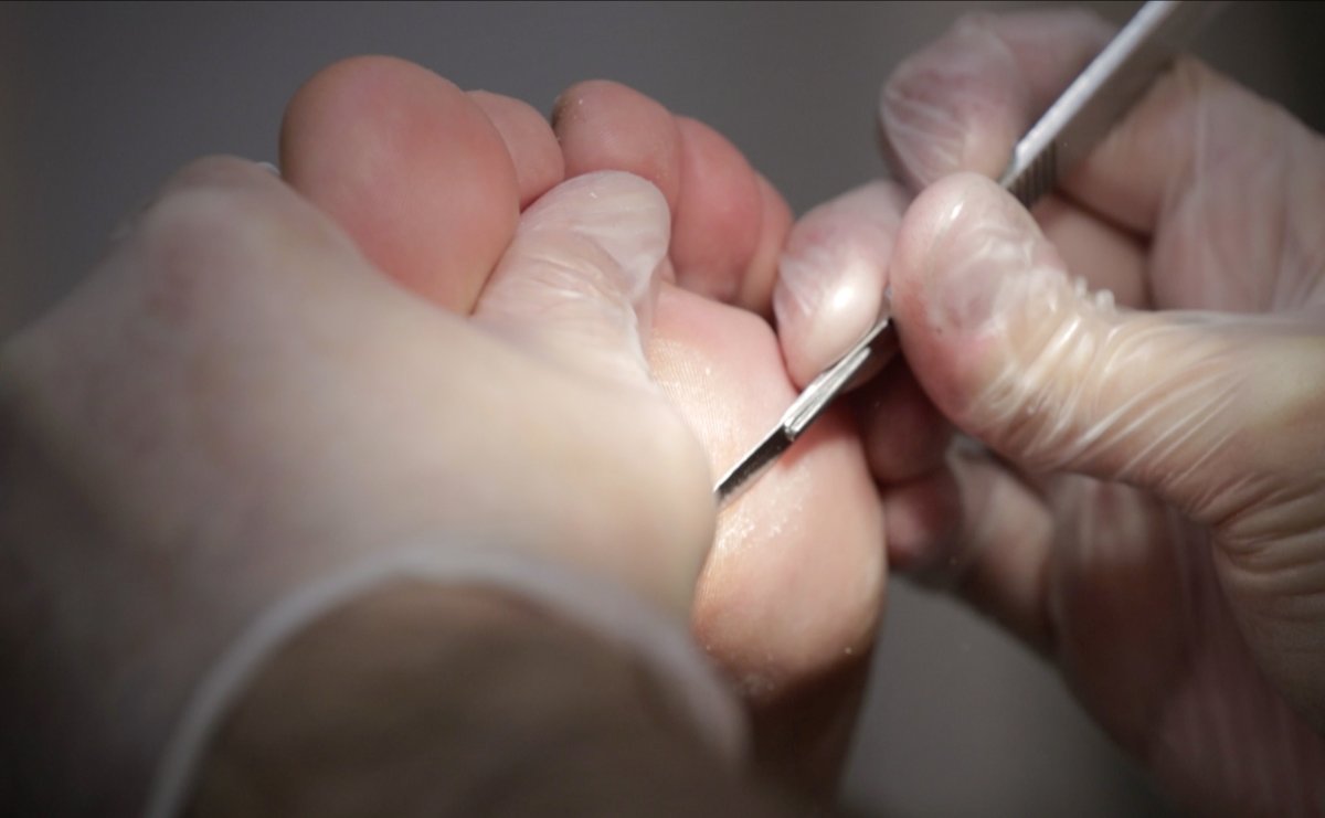 CPodologos's tweet photo. 🔊 #mitos La #podología no duele🚑

Los #podólogos tratamos las alteraciones negativas de los #pies 🦶 con técnicas que no suelen ser dolorosas⚙️

Si doliesen estamos capacitados para anestesiar ✅💤 las zonas más sensibles o doloridas ❤️

➕ info ⬇️
https://t.co/LCSAzbKh7m https://t.co/qy4aBVPPoi