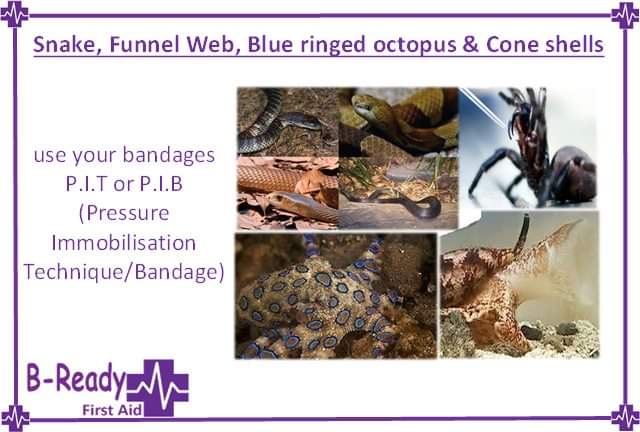 BReadyFirstAid's tweet photo. Snakes 🐍🐍🐍 are still active and out and about.
Do you know how to apply a P.I.T to a casualty's arm or leg???
#BReadyfirstaid #BReadyfirstaidtraining #Firstaid #snakebite #PIT #Funnelweb #blueringedoctopus #coneshells https://t.co/UYtU44joOE