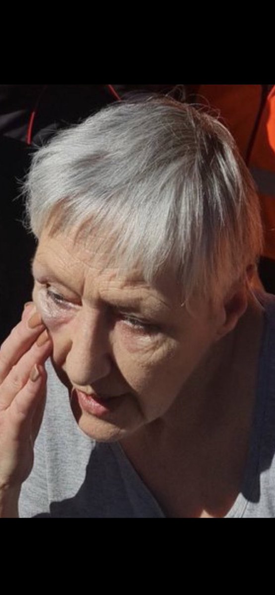 RoseVision2's tweet photo. @OzraeliAvi @ThePosieParker @SeanPlunket Colombian refugee trans who assaulted Posie spends the day skiting.
70 year old Grandmother obviously spent the day tending to her wounds.

Woke Cancel Culture is despicable https://t.co/yUhPJYzWGo