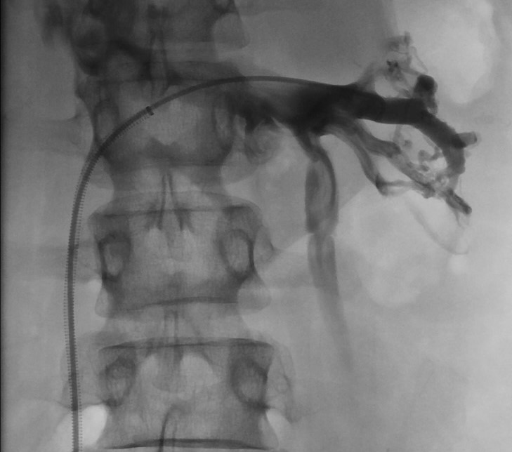 Junior Radiologie Interventionnelle tweet media
