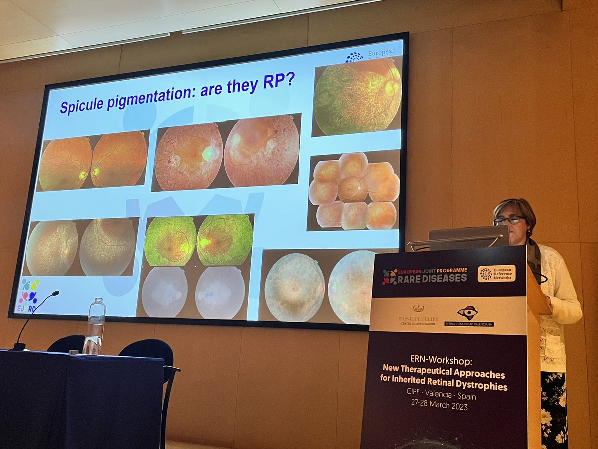 AnaPilarGomez's tweet photo. Talk 2 #ERNworkshop #retinaldystrophies 
Dr. Rosa Coco from University of Valladolid explains clinical basis for diagnosis of IRD 
@CIPFciencia @CIBERER @ReginaRodrigo_ @Canal_Retina @RetinaMurcia @retiprotek https://t.co/Yz4hf4Qxba
