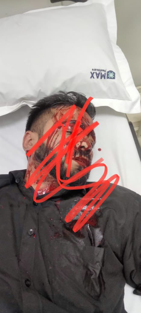 KumaarSaagar's tweet photo. साकेत में काम करने वाले एक बार में मामूली सी कहासुनी पर हिंदू युवक रमेश पर तौमीर मंसूर ने तेज धारधार हथियार से बाहर से लड़के बुला कर किया जानलेवा हमला।

FIR दर्ज लेकिन लेकिन तौमीर दिल्ली पुलिस की गिरफ़्त से बाहर।

@CPDelhi @LtGovDelhi @HMOIndia https://t.co/GV5g0t6P6X
