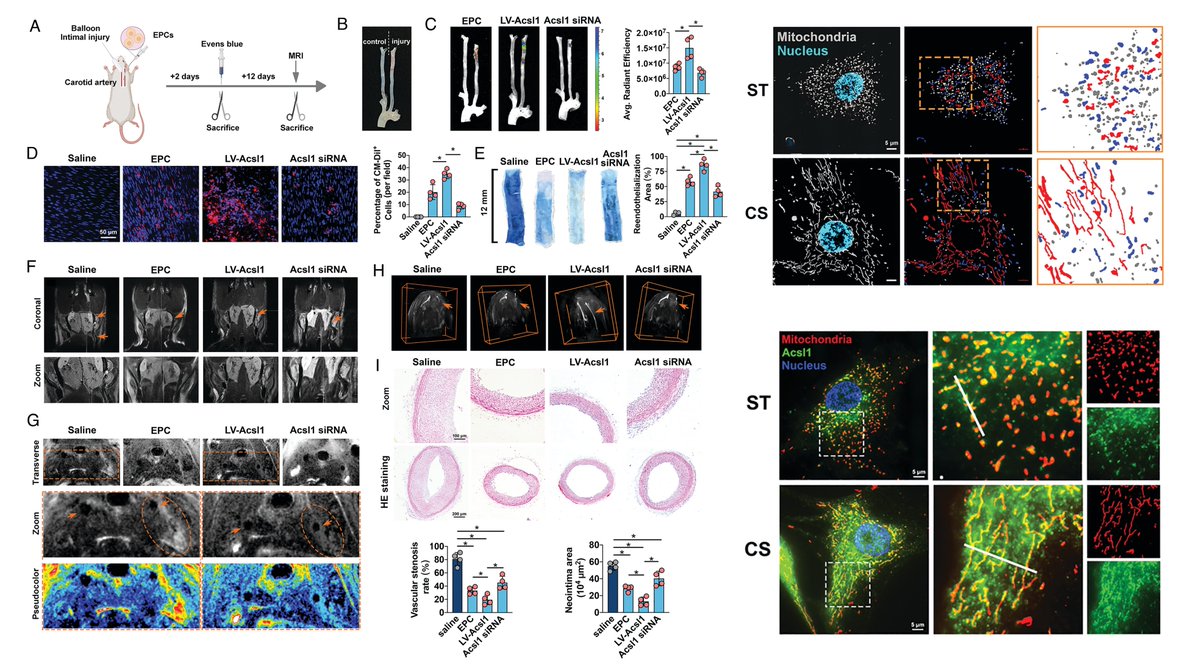 vascularbiology's tweet photo. #NAVBO Member Publication Alert
#CyclicStretch promotes vascular homing of endothelial progenitor cells via Acsl1 regulation of mitochondrial fatty acid oxidation
Dr. Yue Han, John Shyy & Shu Chien groups @PNASNews 2023
https://t.co/aBTgmk4Kia https://t.co/N5Pe75CVHJ