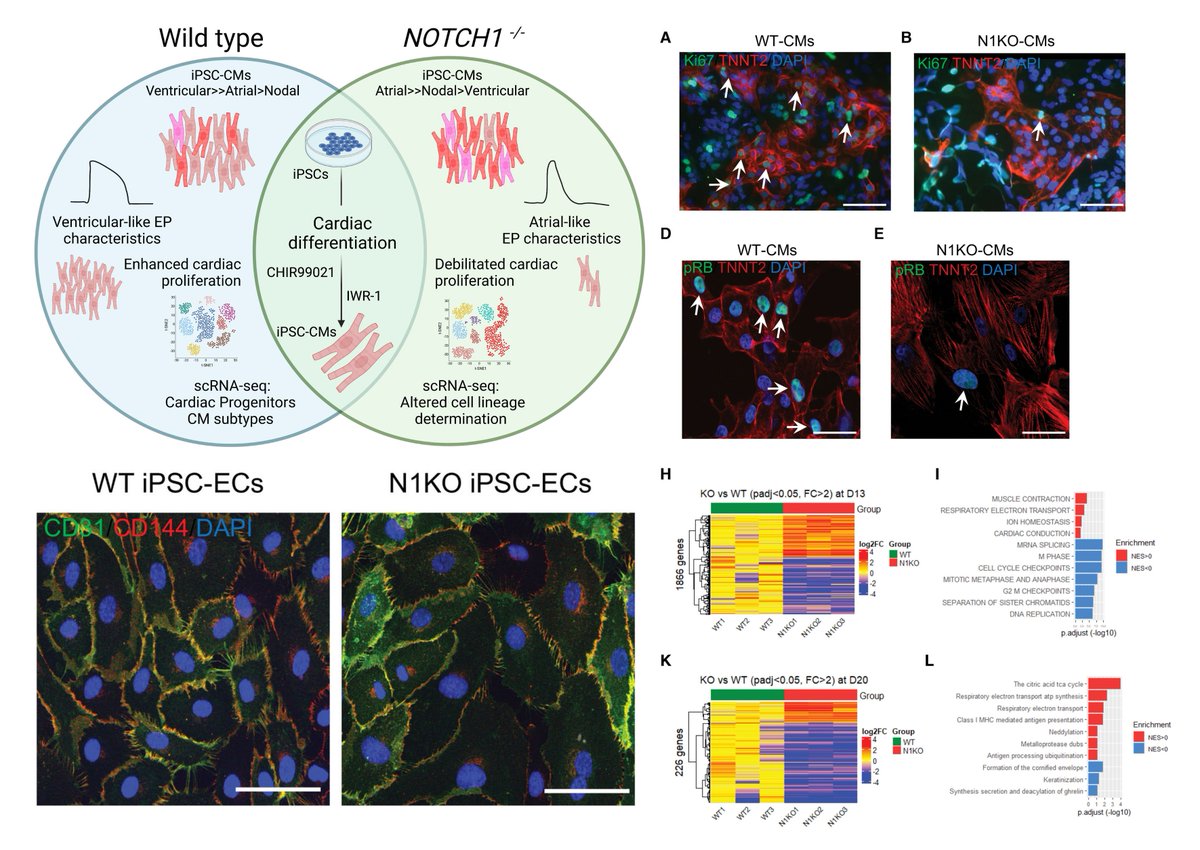 NAVBO (@vascularbiology) on Twitter photo #NAVBO Member Publication Alert
Impaired Human Cardiac Cell Development due to NOTCH1 Deficiency
Dr. Ming-Tao Zhao group <a href="/CircRes/">Circulation Research</a> 2022 <a href="/adhicary/">Subhodip Adhicary</a> <a href="/Joseph_C_Wu/">Joseph C Wu, MD, PhD</a>
ahajournals.org/doi/full/10.11… #NAVBO Member Publication Alert
Impaired Human Cardiac Cell Development due to NOTCH1 Deficiency
Dr. Ming-Tao Zhao group <a href="/CircRes/">Circulation Research</a> 2022 <a href="/adhicary/">Subhodip Adhicary</a> <a href="/Joseph_C_Wu/">Joseph C Wu, MD, PhD</a>
ahajournals.org/doi/full/10.11…